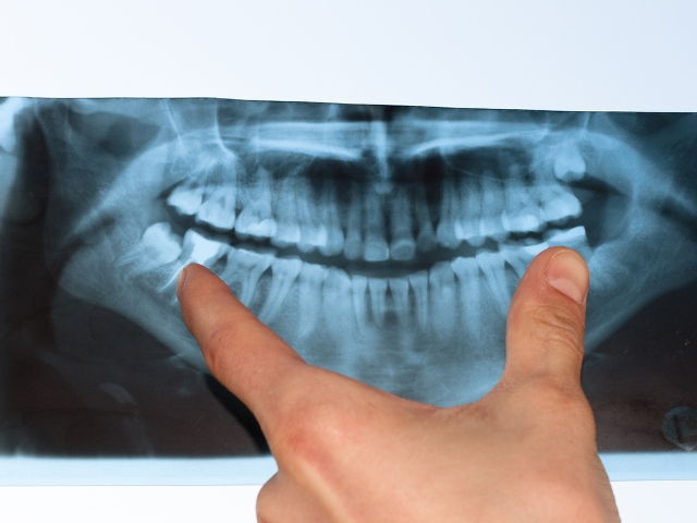 Interesujące fakty, których nie wiedzieliście o zębach