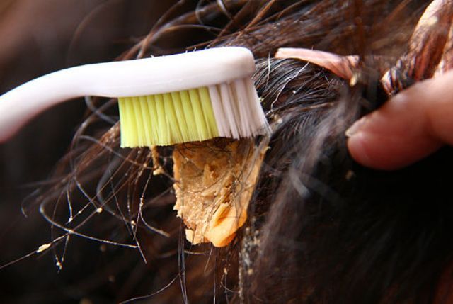 Wie man Kaugummi aus dem Haar entfernt