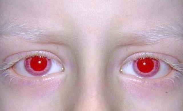 Menschen mit braunen Augen sind zuverlässiger und andere Fakten über die Farbe der Augen