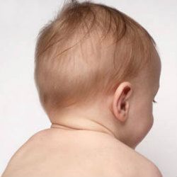 Dziecko: асимметрия формы черепа и как с ней справляться