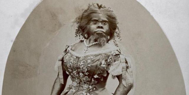 Die hässlichste Frau der Welt ist in 150 Jahren begraben