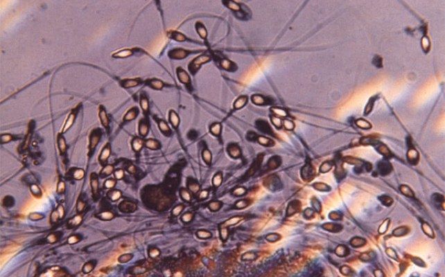 "Înotătorii" sexuali: 7 fapte despre spermatozoizi