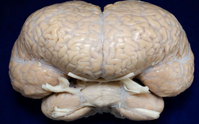 Niesamowite cechy mózgu zwierząt