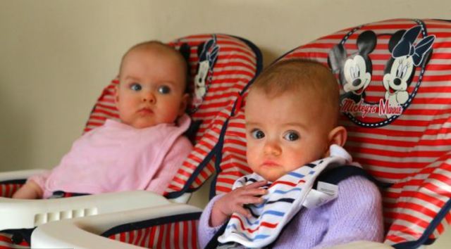 I Irland ble tvillinger født med en forskjell på 87 dager
