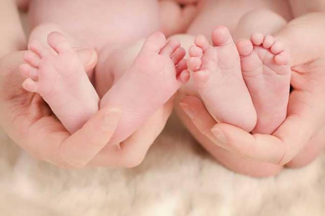 V Irsku se narodily dvojčata s rozdílem 87 dní